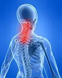 Everyday Activities Causing Neck and Back Pain