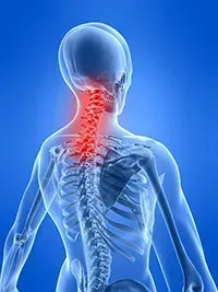 Everyday Activities Causing Neck