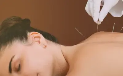 What Acupuncture Can Do for You