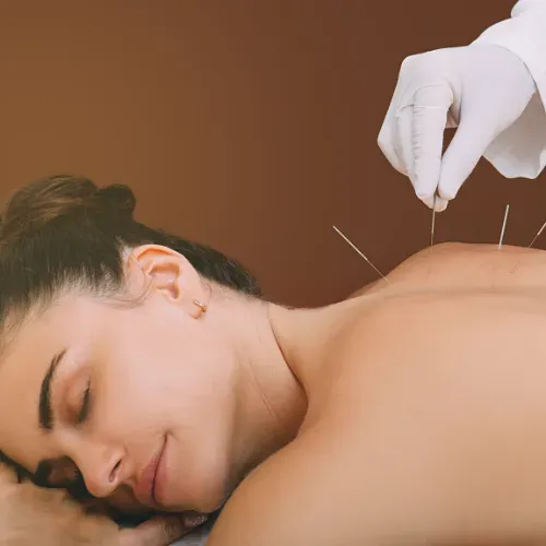 Does Acupuncture Actually Help