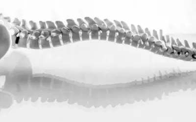 HOW DID CHIROPRACTIC START? A SHORT STORY OF THE HISTORY OF CHIROPRACTIC